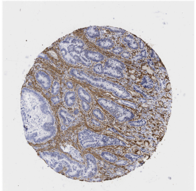 Article Update 08e51ce6 Affe 4b2c 8bfc Aa0fd4b3b125 - Cobblestone (680x383), Png Download