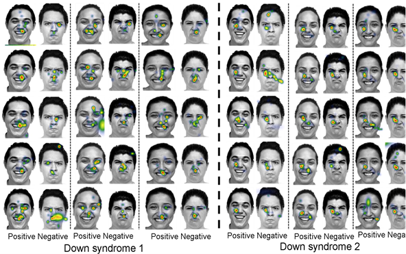 Male Ds Eye Fixation Time Compared To A Ds Female Eye - Poster (903x370), Png Download