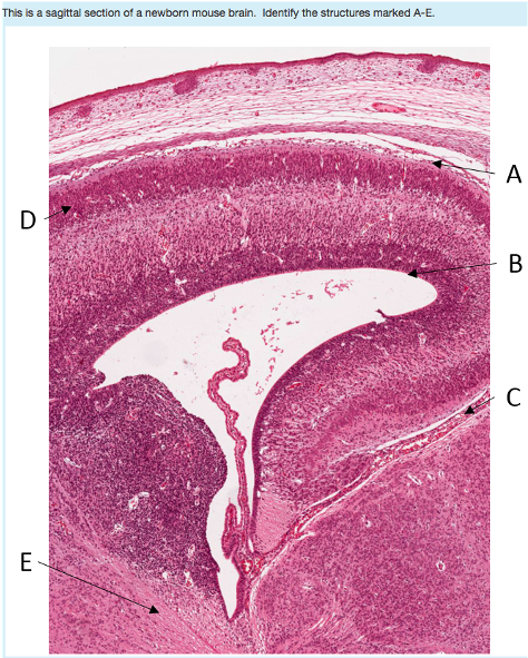 Choose - Sagittal Plane (1024x640), Png Download