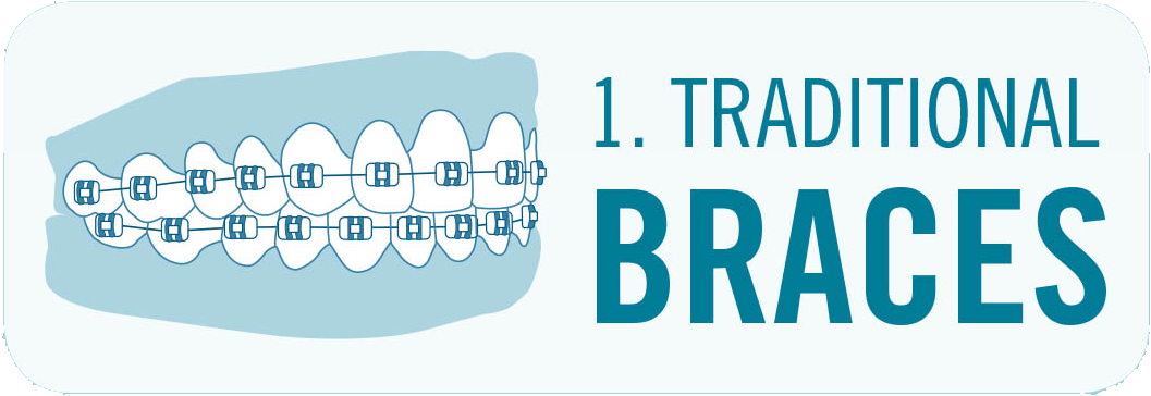 Traditional Braces Image With Teeth - Blue Ridge Orthodontics (1117x413), Png Download