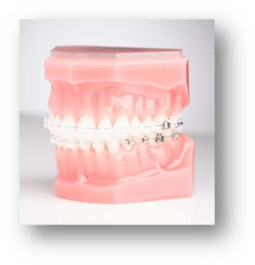 Self Ligating Ceramic Braces - Plastic (381x395), Png Download