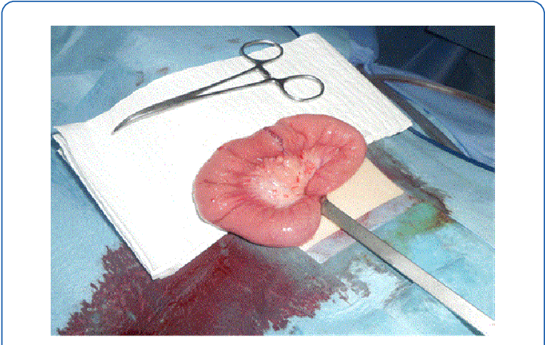 Operative View After Partial Small Bowel Resection - Still Life (769x487), Png Download