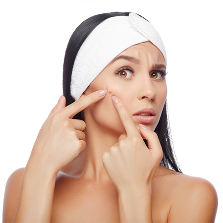 How To Fight Acne - Blackhead Spot Removal Tweezer Facial Pimple Popping (450x450), Png Download