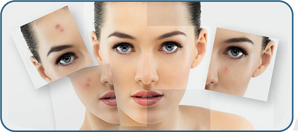 Acne - Imag1 - Salica Acne Face Wash And Cleanser With Salicylic Acid (1025x474), Png Download