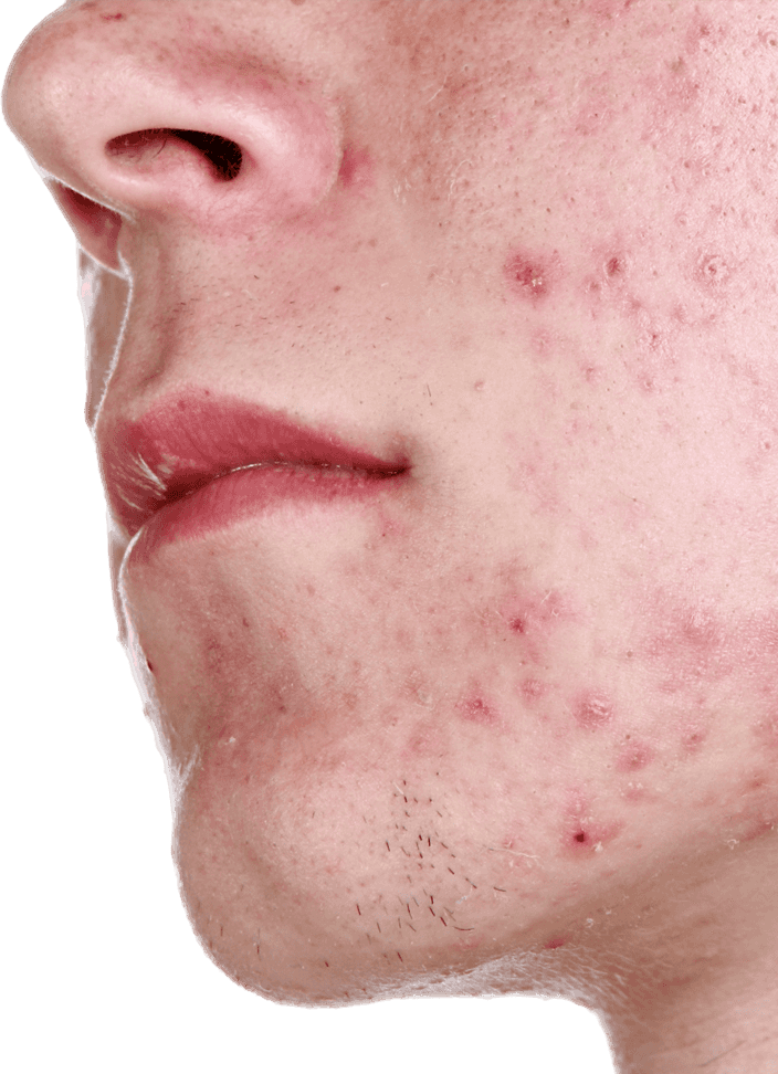 Bcaa Side Effects (704x972), Png Download