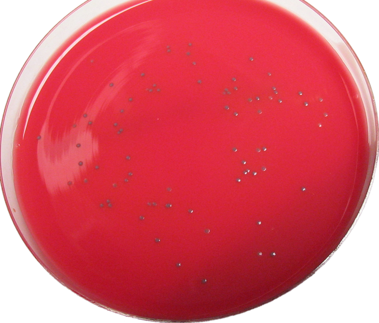 Smooth L'mono-trans - Listeria Monocytogenes On Dra Agar (1288x1097), Png Download