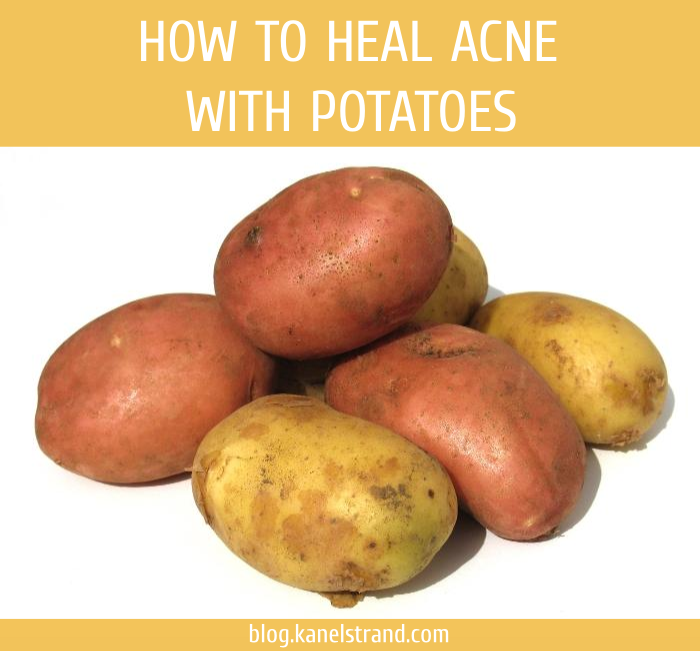 How To Heal Acne With Potatoes - Few Potatoes (700x651), Png Download