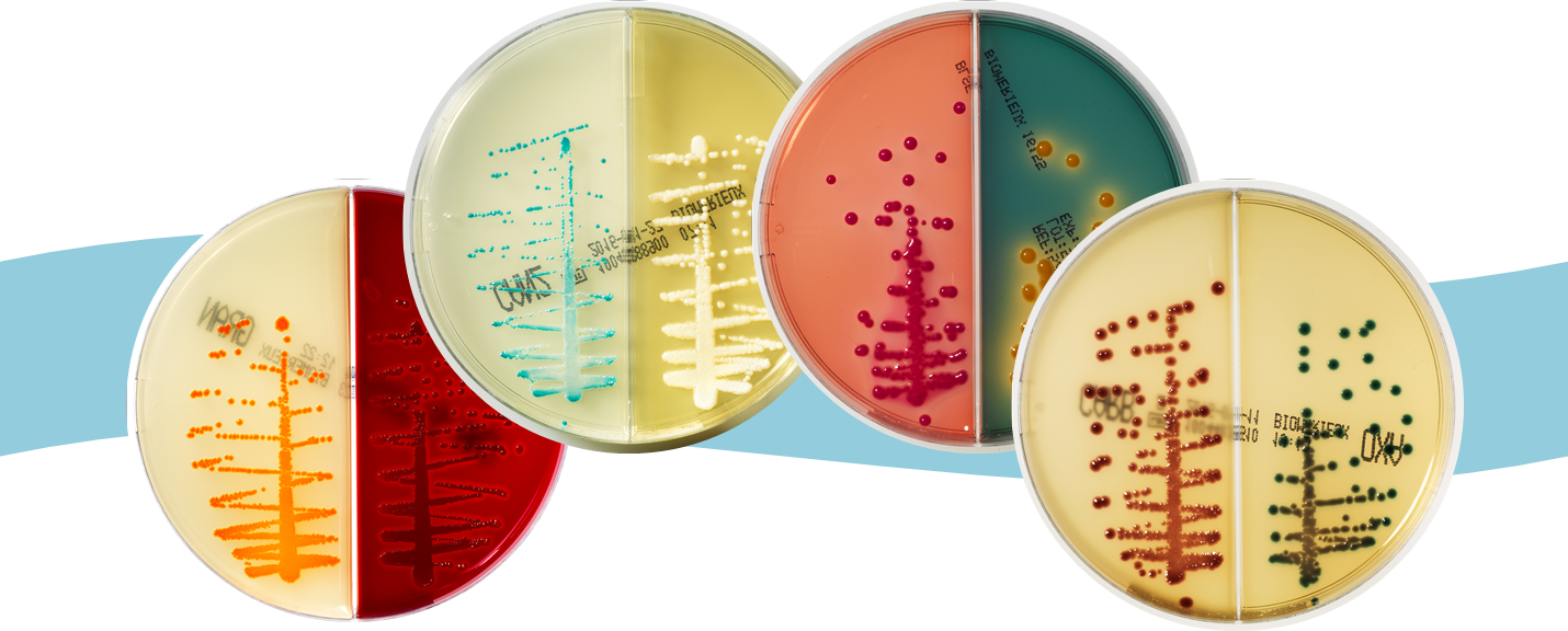 Bi-plate Range - Biplate Streak (1430x576), Png Download