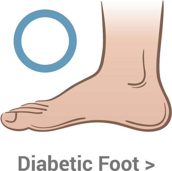 Diabetes Can Have A Significant Effect On Your Feet - Foot (700x700), Png Download