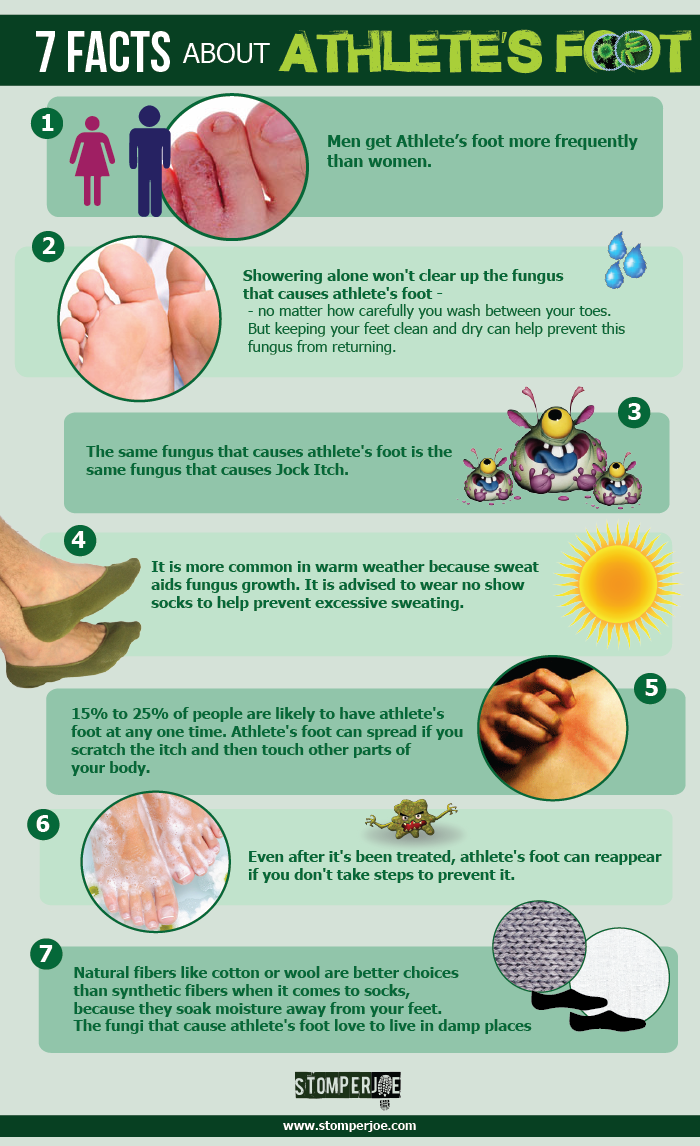 Athletes Foot Pop Up 2 - Bee (700x1146), Png Download