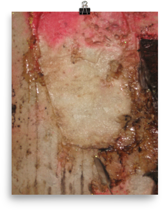 Happy Accident - Accident (1000x1000), Png Download