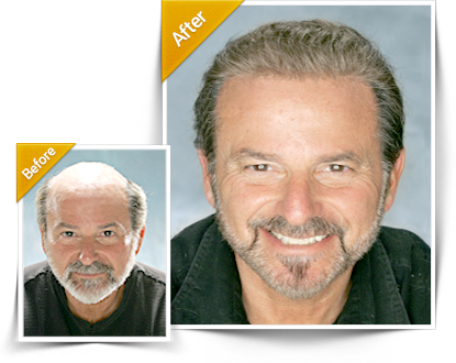 Hairpieces For Men Hair Piece Before And After Full Size Png