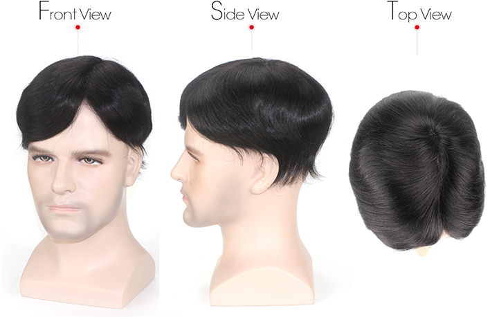 Advantage, Hair Looks Like Growing Out Of The Scalp - Ear (725x525), Png Download