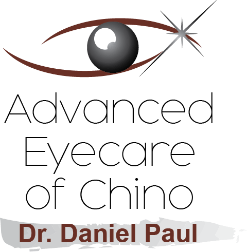 Specialty Contact Lens Fitting - Chino (480x491), Png Download