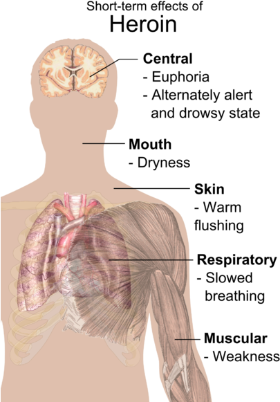 Short-term Effects Of Heroin - Heroin Effects (413x600), Png Download