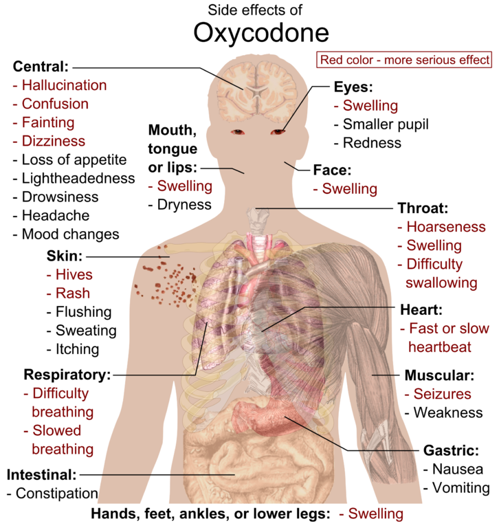 Side Effects Of Oxycodone - Cat Drug Side Effects (726x768), Png Download