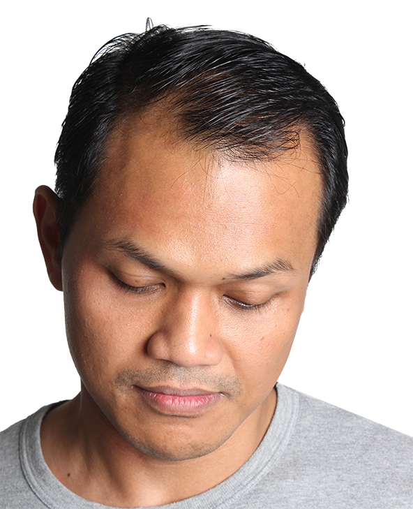 Aremyhair - Man (592x729), Png Download