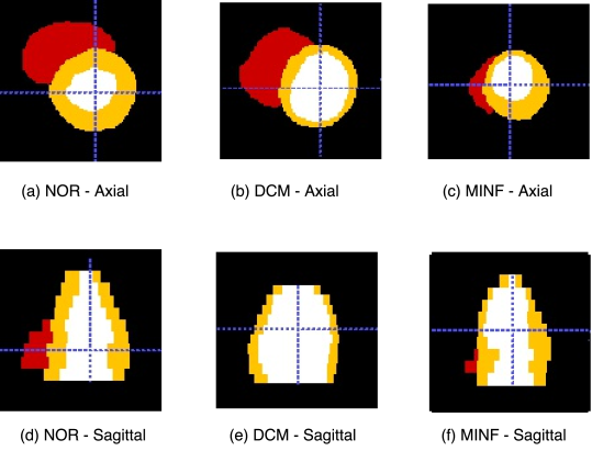 The Figures Shows The Short Axis Cardiac Segmentation - Circle (539x411), Png Download