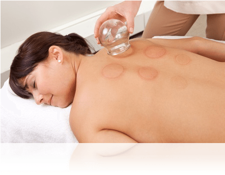 Lady Having Acupuncture - Acupuncture (457x380), Png Download