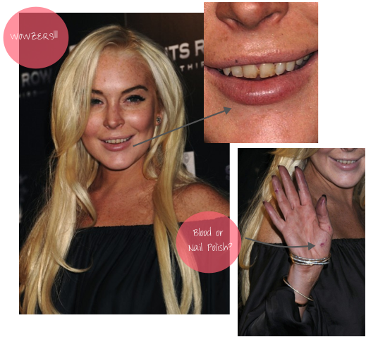 You - Lindsay Lohan 2018 Drugs (519x478), Png Download