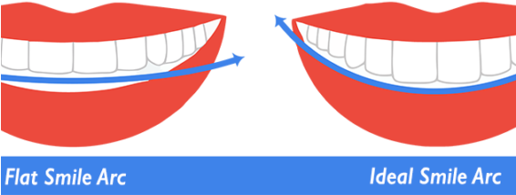 La Habra/chino Hills, Ca Gire Orthodontics Is An Orthodontic - Flat Vs Curve Smile Arc (565x265), Png Download