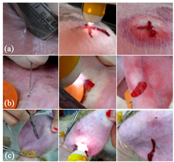 Photos Showing ) Cutting By A Scalpel, Treating This - Art (903x319), Png Download