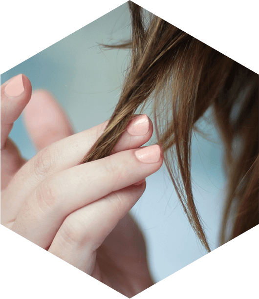 Woman With Hair Loss Touching Hair - Hair Loss (530x612), Png Download