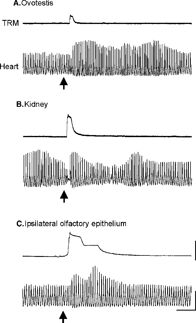 Arrows Indicate Timing Of A Light Brush Stroke Over - Diagram (680x1119), Png Download