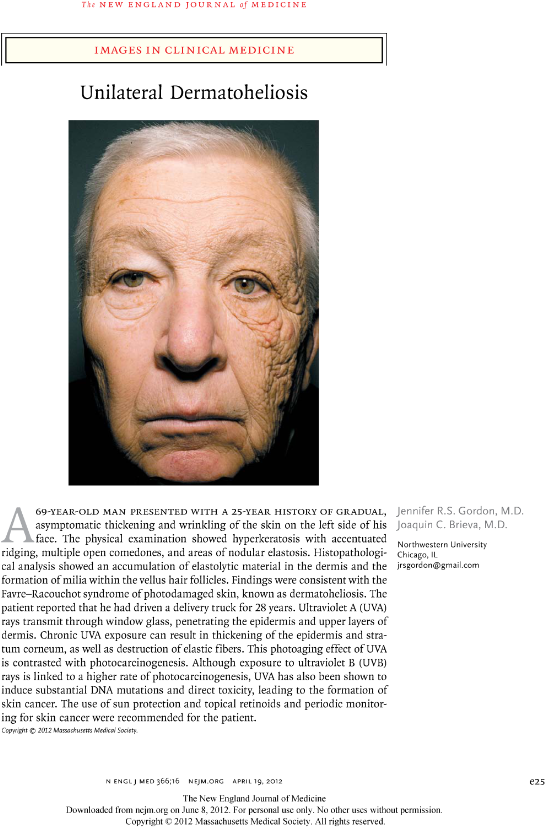 Shocking Proof Of The Effects Of Sun On Aging - Bill Mcelligot (572x833), Png Download