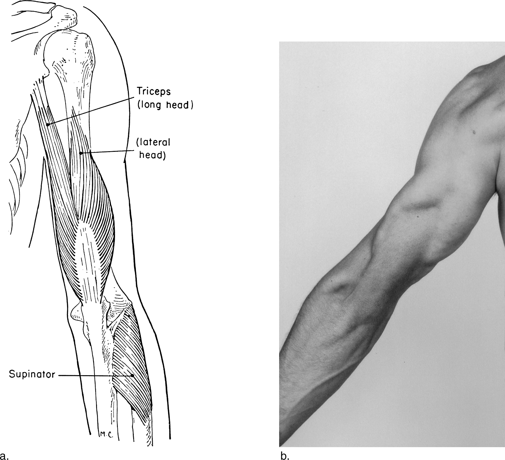 Image Not Available - Kinesiology Scientific Basis Of Human Motion Adductor (1650x1503), Png Download