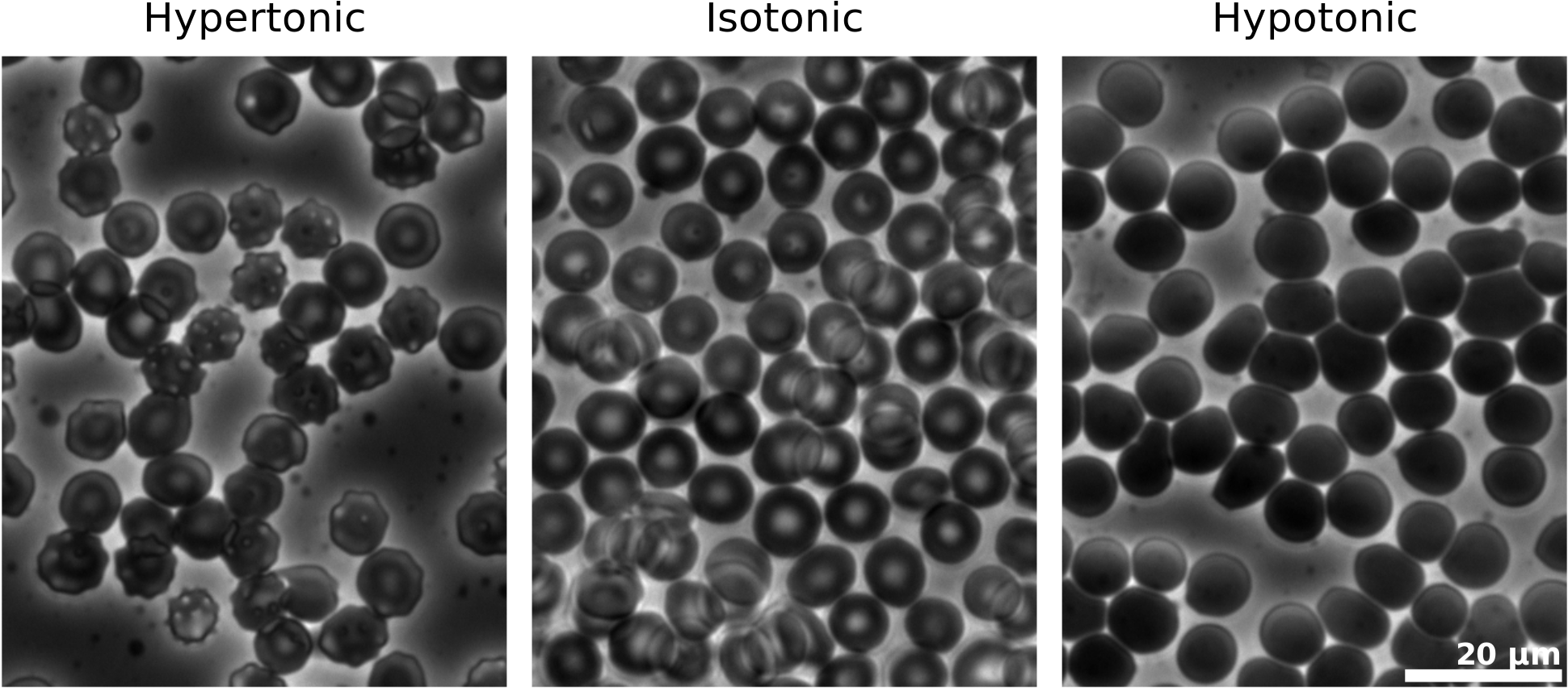 Open - Hypotonic Solution Under Microscope (2000x906), Png Download