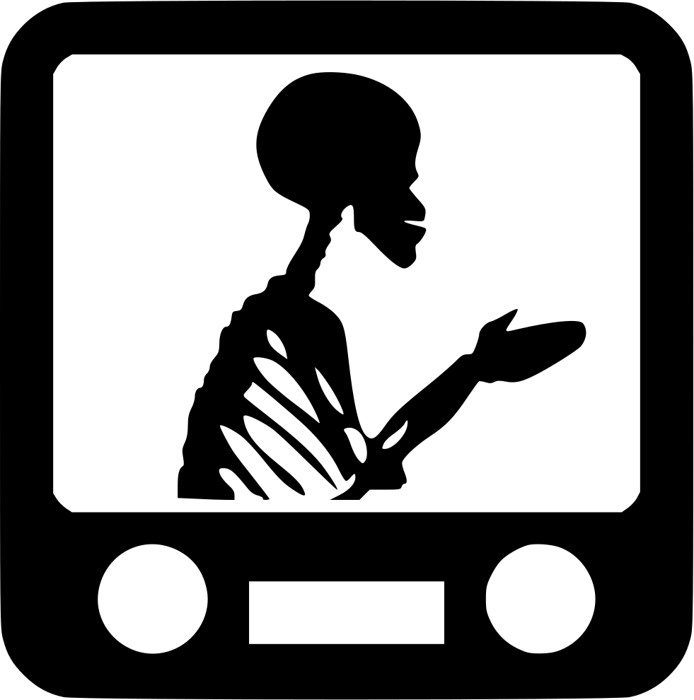 Xray Medical Health X Ray Medicine Human Skeleton Comments - Medicine (981x990), Png Download