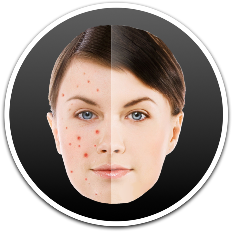 Perfect Mole On Face (1600x1000), Png Download