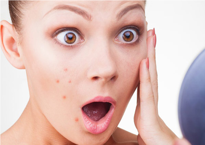 Face With Few Pimples (870x470), Png Download
