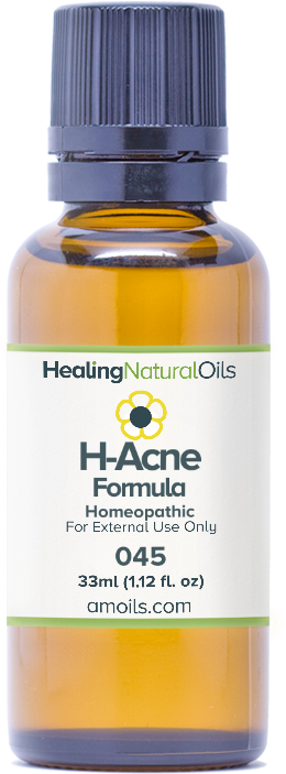 Formula H-acne Formula - Cold Sore Symptoms Before (768x768), Png Download
