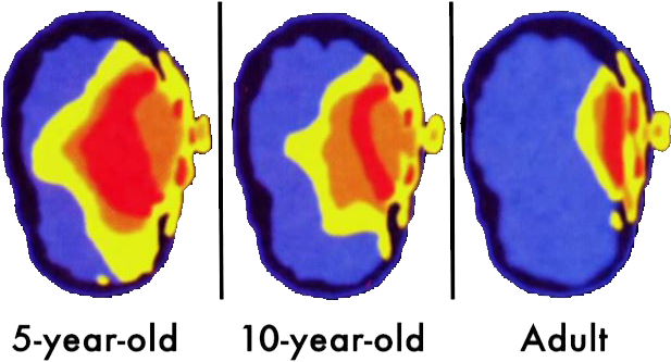 Research Shows That The Effects Of This Can Be Even - Phone Radiation (667x343), Png Download