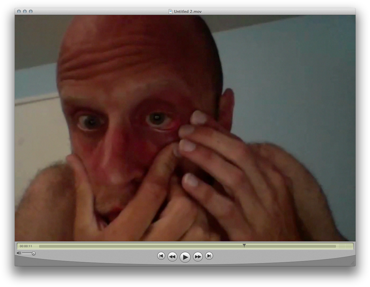 The Brown, Dark Spot On My Left Eye Is A Cloaked Demonic - Eye (1267x988), Png Download