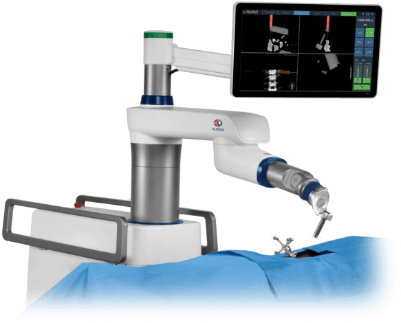 Hartford Healthcare Pioneers Robotic-assisted Spine - Excelsius Gps (600x496), Png Download