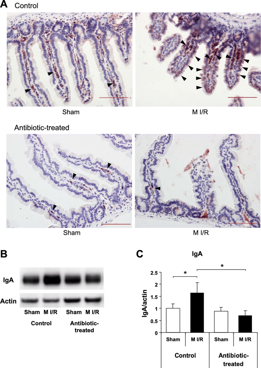 Iga Deposition In Small Intestine Following M I R We - Number (850x1201), Png Download