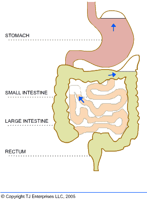 Trapped Gas Causes Blockages And Bloating In The Intestines - شكل الغازات في البطن (302x407), Png Download