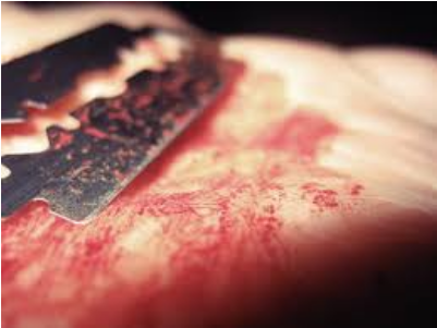 Boy Cutting His Hand With Blade (500x300), Png Download
