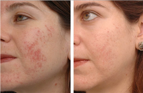 Members' Booking Form - Garmi Danay On Face (600x480), Png Download