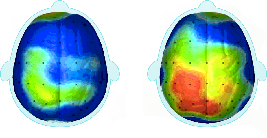 A Simple 20 Minute Walk Can Be Profoundly Stimulating - Brain With Physical Activity (923x478), Png Download