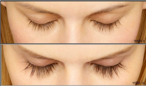 Feg Eyelash Enhancer Eyelash Serum Eyelash Growth Serum - Hubee Eyelashes Growth Powerful Serum Thick Eye Lash (500x500), Png Download