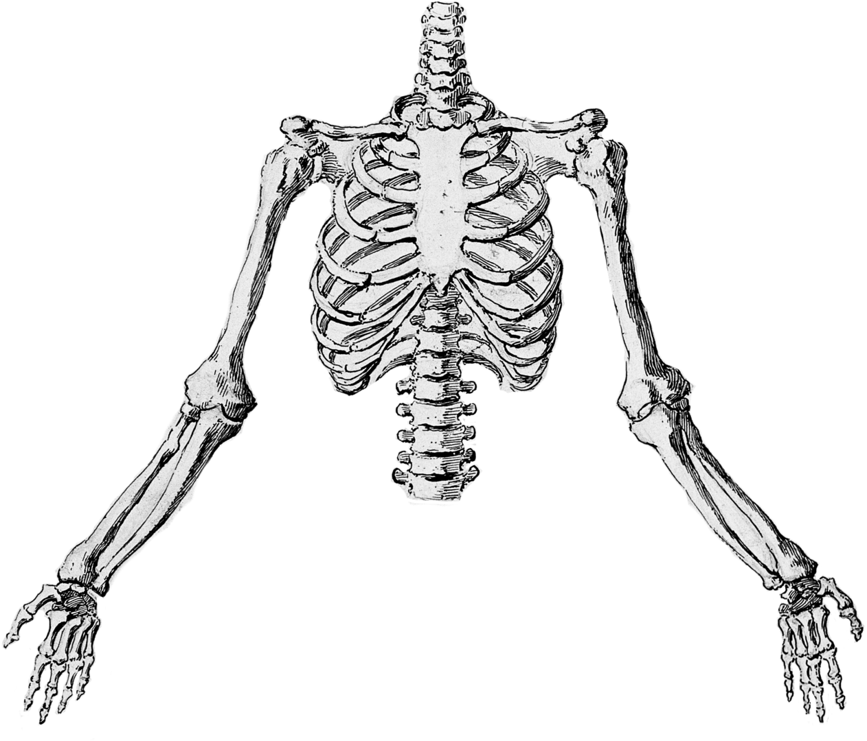 Radiographs Were Easy Enough To Come By Hospitals Produced - Illustration (1600x1178), Png Download