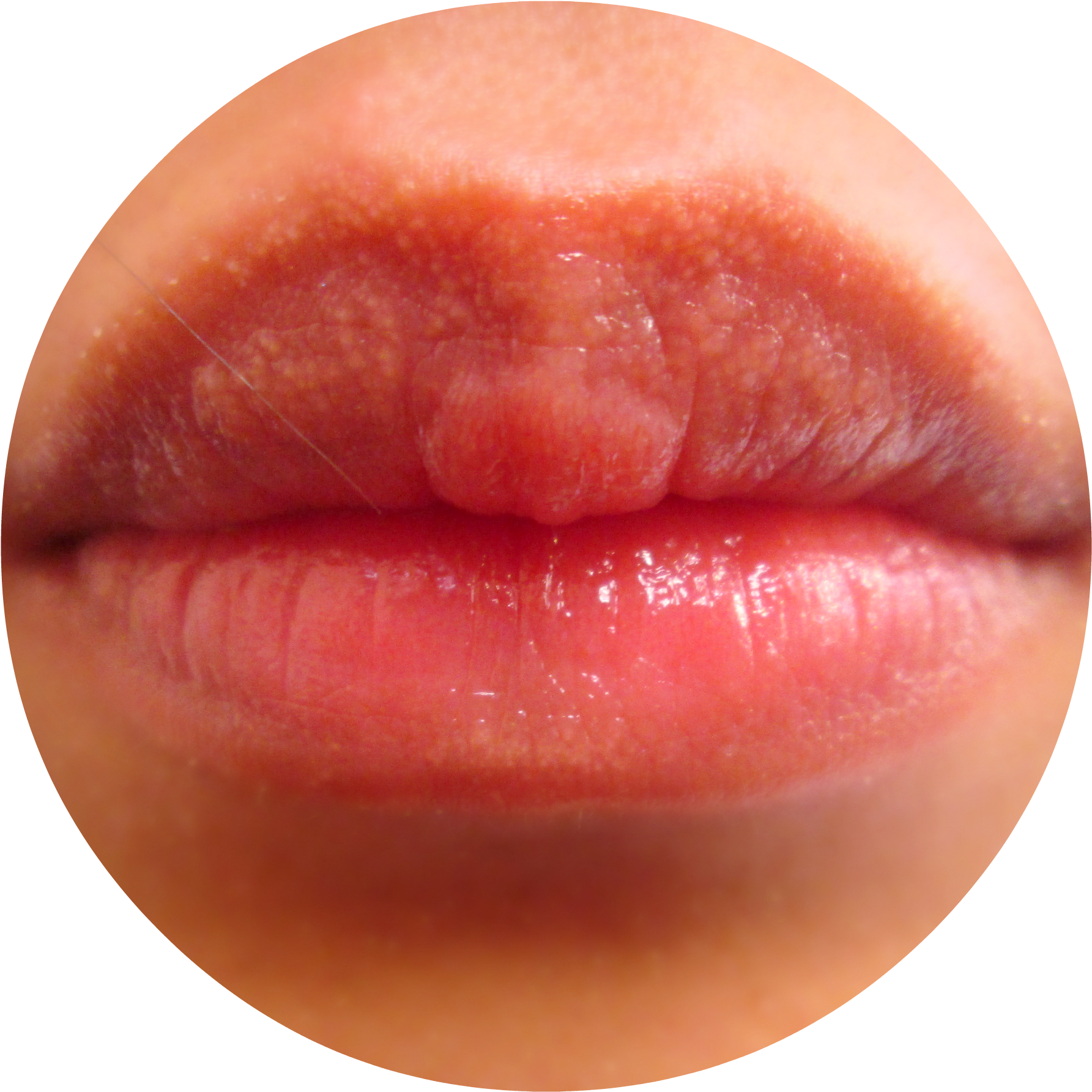 2 - Discolored Lip (1818x1824), Png Download