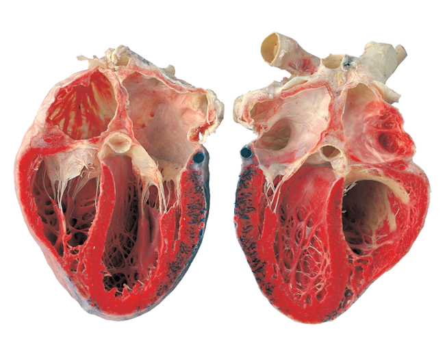 Open-heart - Food That Looks Like The Heart (650x532), Png Download