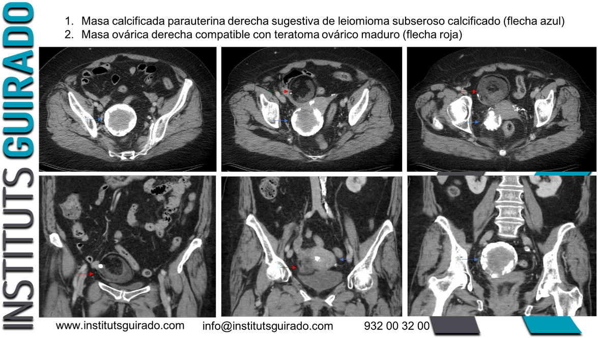 Instituts Guirado - Computed Tomography (1200x672), Png Download