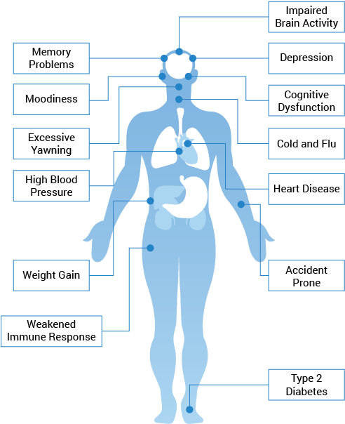 Somnuva Graphics Health Issues Associated With Sleep3 - Health (514x628), Png Download