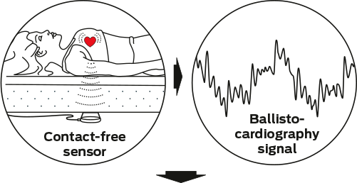 Emfit Icons Sleep Monitor - Phoenix Photographic Technology Company (501x258), Png Download